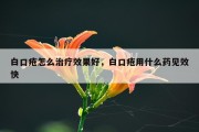 白口疮怎么治疗效果好，白口疮用什么药见效快