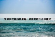 牙周炎吃啥药效果好，牙周炎吃什么药能好