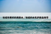 祛痘效果好的爽肤水，祛痘的水乳护肤品推荐