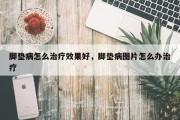 脚垫病怎么治疗效果好，脚垫病图片怎么办治疗