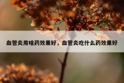 血管炎用啥药效果好，血管炎吃什么药效果好