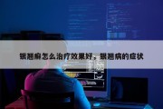 银翘癣怎么治疗效果好，银翘病的症状